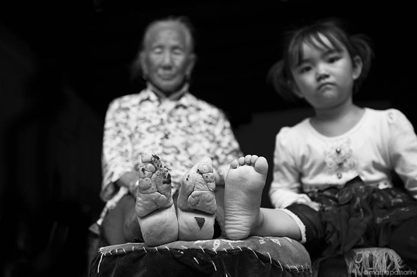 Зачем в Китае бинтовали ноги девушки - туфли лотосы